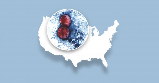 Latest updated map tracking 'explosive diarrhea' cases in Maryland, US